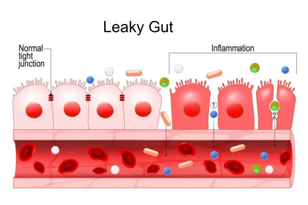 Leak Gut Diagram - Carine Pieterse -Natural Health
